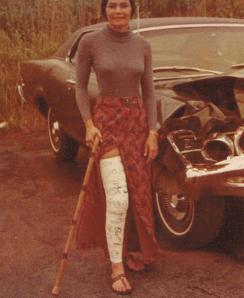 Auntie Brenda's Famous Broken Leg, c.1973